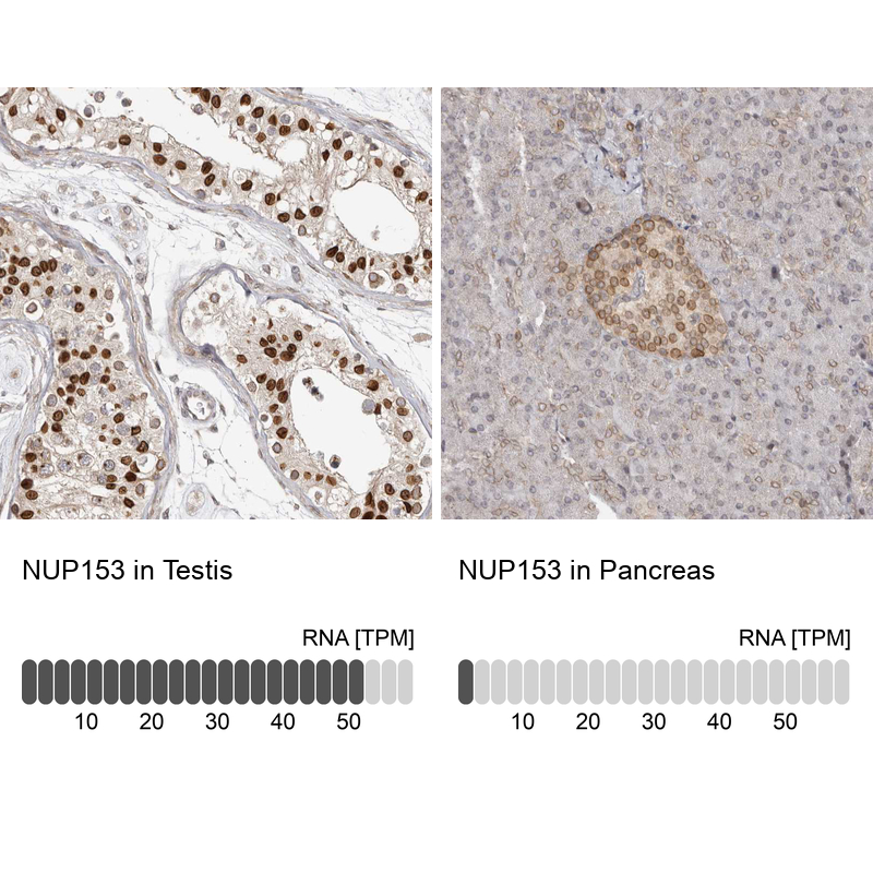 Atlas Antibodies Anti-NUP153 Antibody
