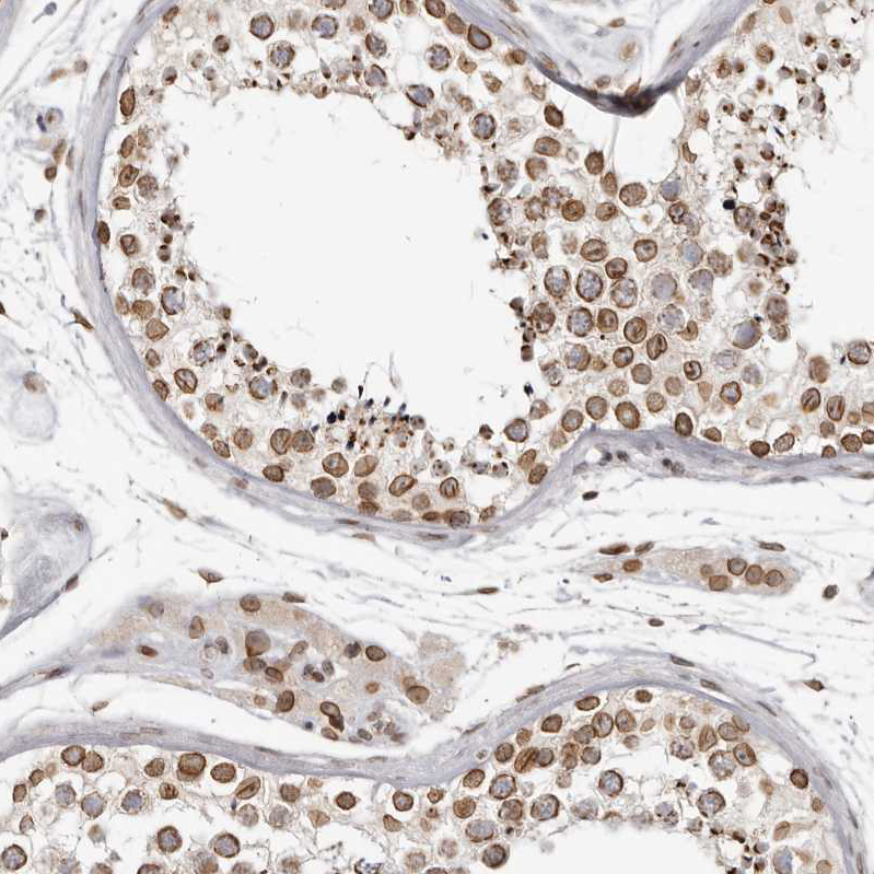 Atlas Antibodies Anti-NUP153 Antibody