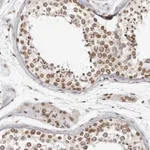 Atlas Antibodies Anti-NUP153 Antibody