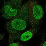 Atlas Antibodies Anti-NUP153 Antibody