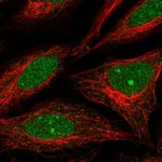 Atlas Antibodies Anti-NUP188 Antibody