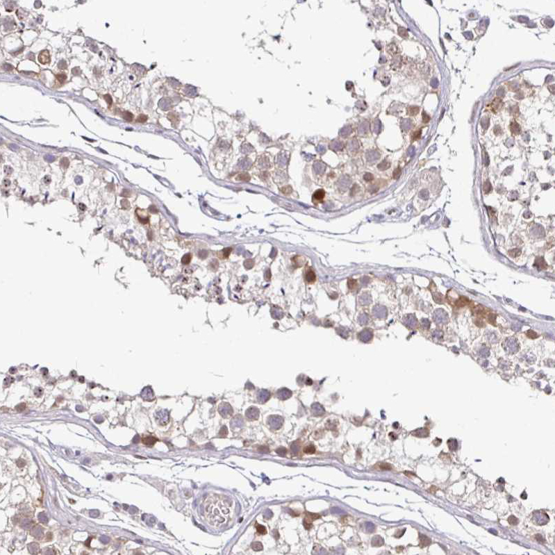 Atlas Antibodies Anti-NUP188 Antibody