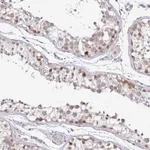 Atlas Antibodies Anti-NUP188 Antibody