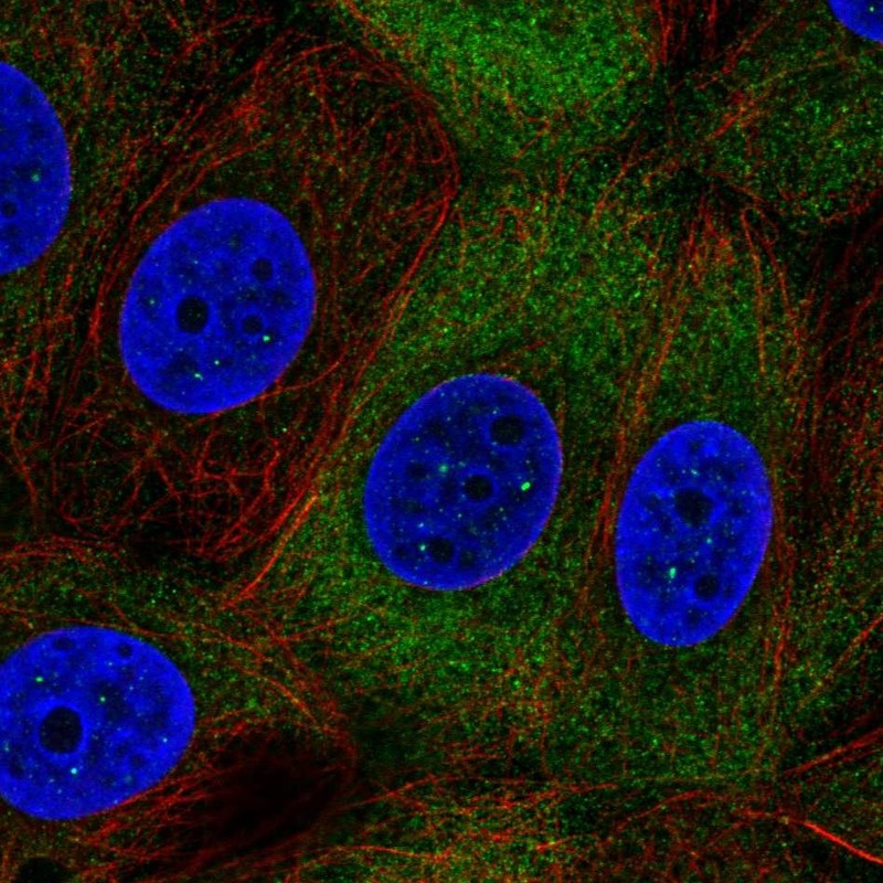 Atlas Antibodies Anti-NUP210L Antibody