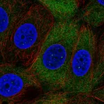 Atlas Antibodies Anti-NUP210L Antibody