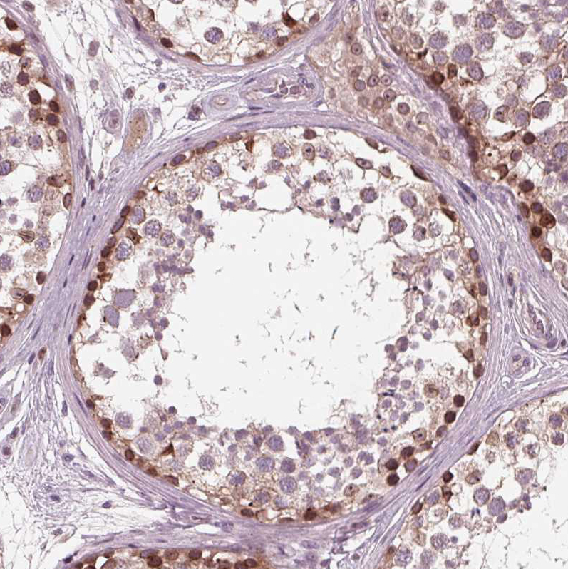 Atlas Antibodies Anti-NUP210 Antibody