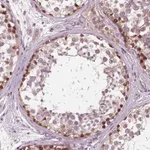 Atlas Antibodies Anti-NUP210 Antibody