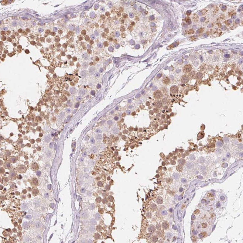 Atlas Antibodies Anti-NUP210L Antibody