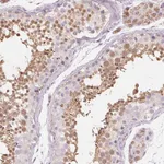 Atlas Antibodies Anti-NUP210L Antibody