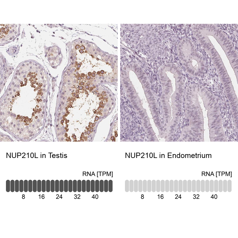 Atlas Antibodies Anti-NUP210L Antibody