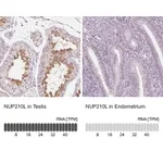 Atlas Antibodies Anti-NUP210L Antibody