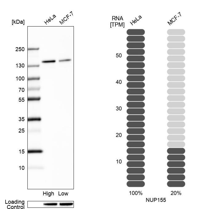 Atlas Antibodies Anti-NUP155 Antibody