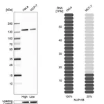 Atlas Antibodies Anti-NUP155 Antibody