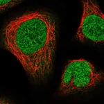 Atlas Antibodies Anti-NUP214 Antibody