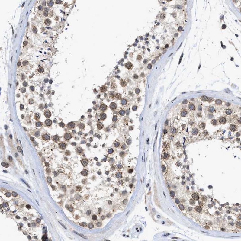 Atlas Antibodies Anti-NUP35 Antibody