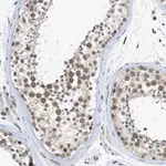 Atlas Antibodies Anti-NUP35 Antibody