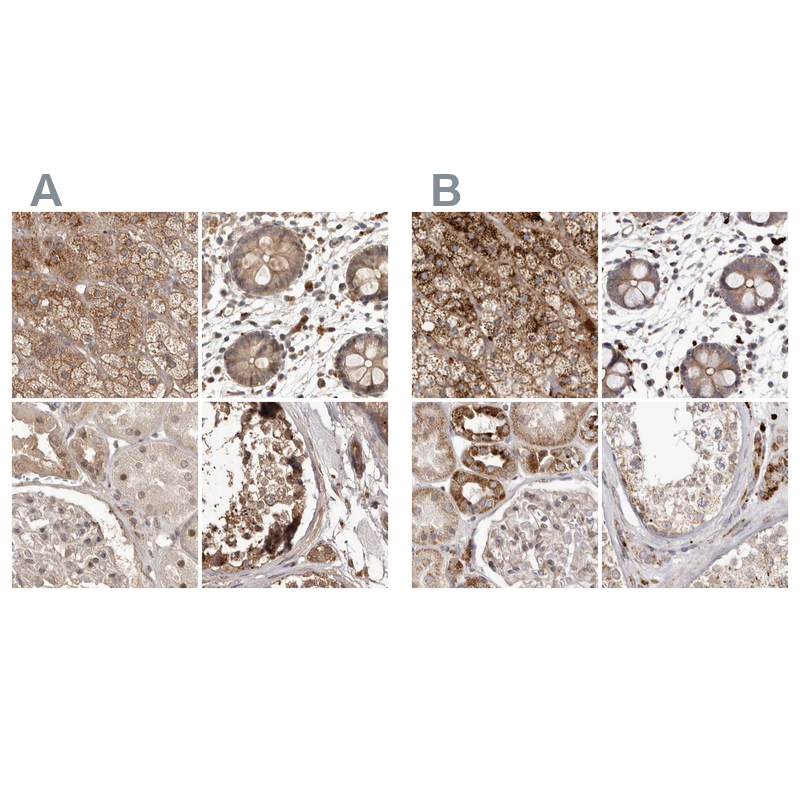 Atlas Antibodies Anti-NUP43 Antibody