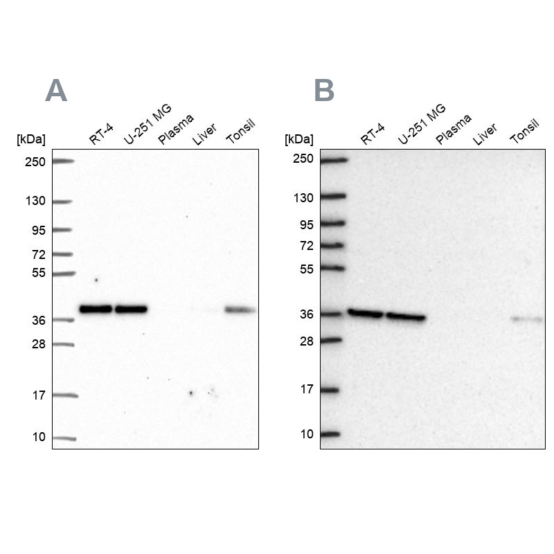 Atlas Antibodies Anti-NUP37 Antibody