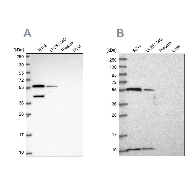 Atlas Antibodies Anti-NUP50 Antibody