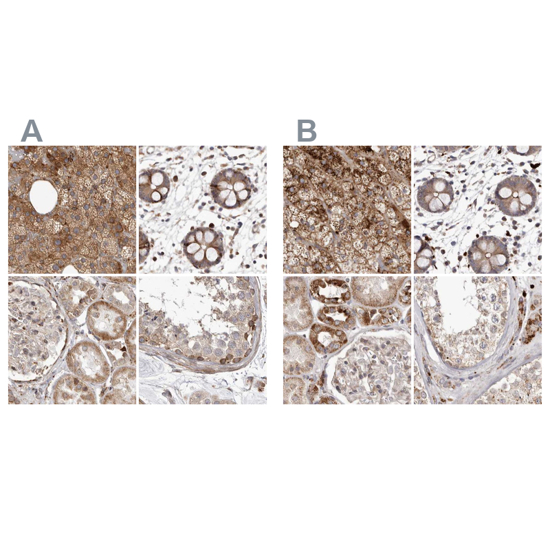 Atlas Antibodies Anti-NUP43 Antibody