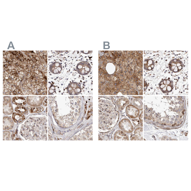 Atlas Antibodies Anti-NUP43 Antibody