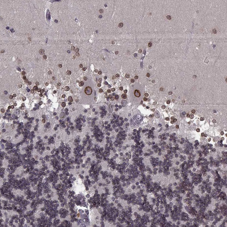 Atlas Antibodies Anti-NUP37 Antibody