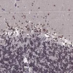 Atlas Antibodies Anti-NUP37 Antibody
