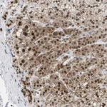 Atlas Antibodies Anti-NUP35 Antibody