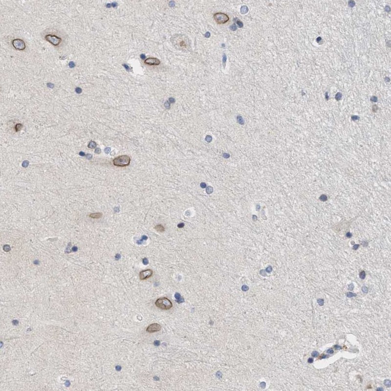 Atlas Antibodies Anti-NUP35 Antibody
