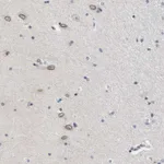 Atlas Antibodies Anti-NUP35 Antibody