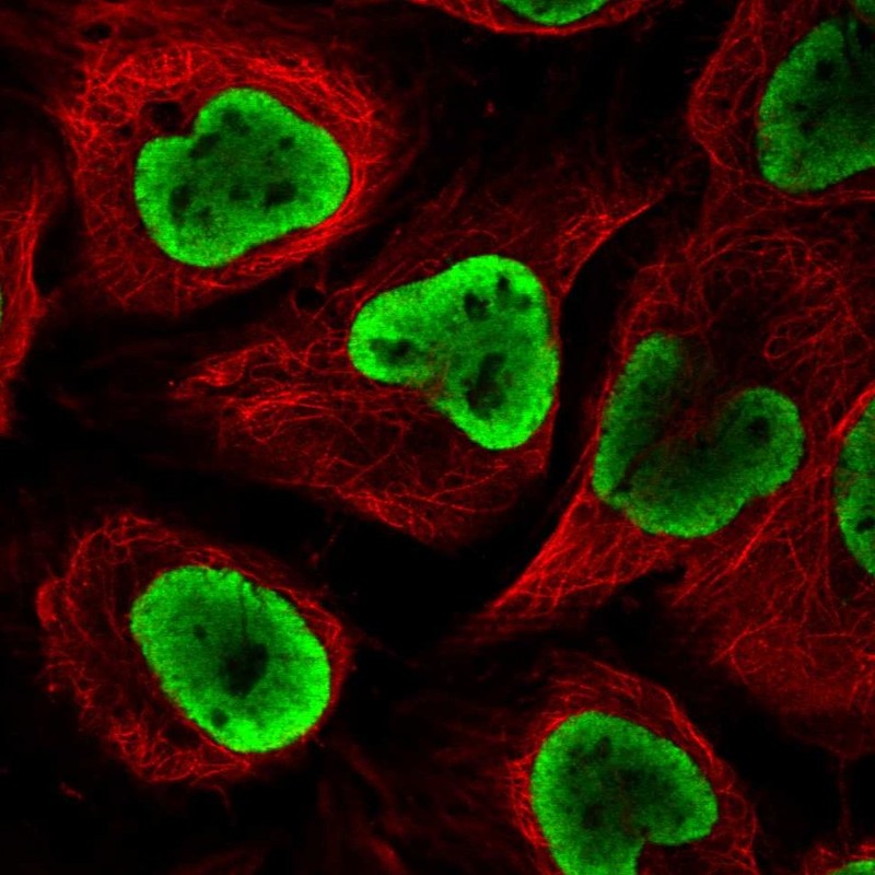 Atlas Antibodies Anti-NUP54 Antibody