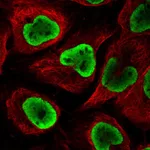 Atlas Antibodies Anti-NUP54 Antibody