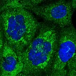Atlas Antibodies Anti-NUP58 Antibody