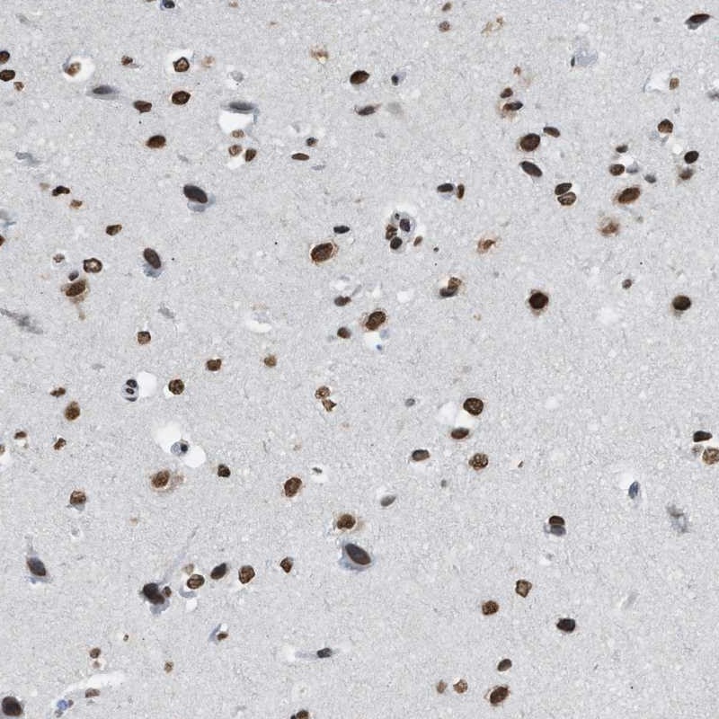 Atlas Antibodies Anti-NUP88 Antibody