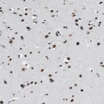 Atlas Antibodies Anti-NUP88 Antibody