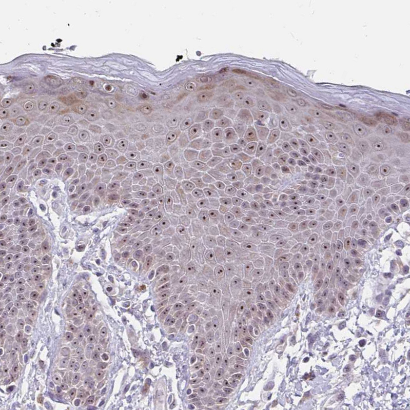 Atlas Antibodies Anti-NUP85 Antibody