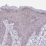 Atlas Antibodies Anti-NUP85 Antibody