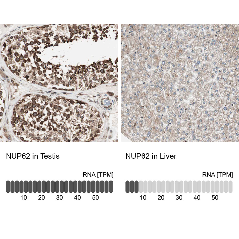 Atlas Antibodies Anti-NUP62 Antibody