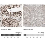 Atlas Antibodies Anti-NUP62 Antibody