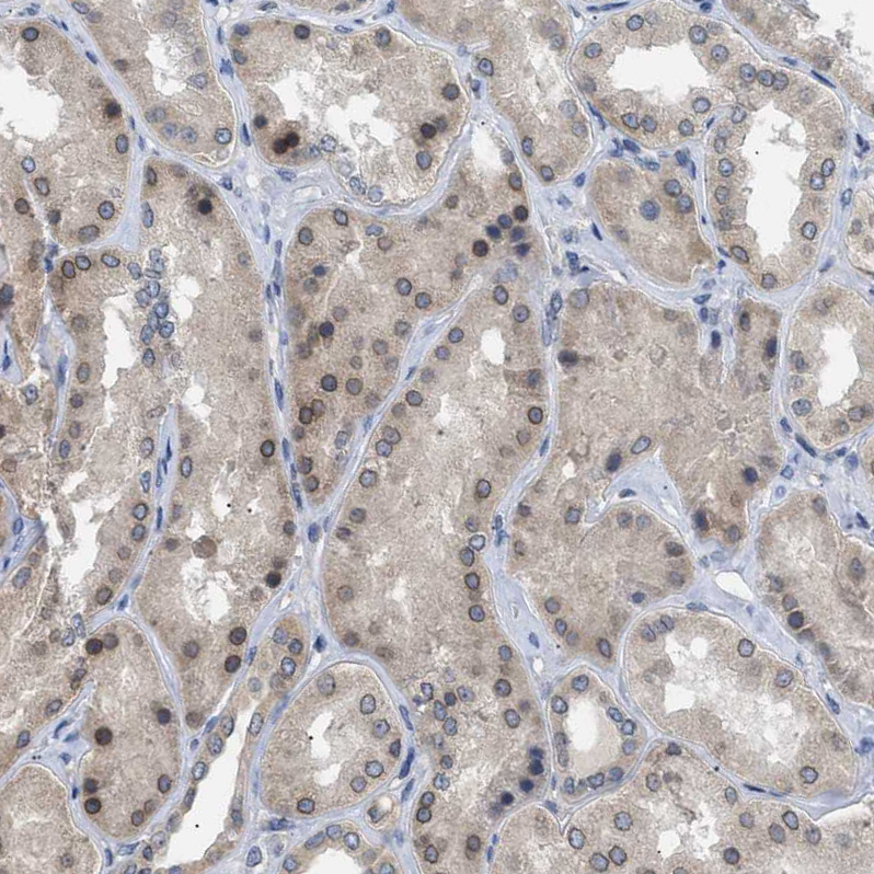 Atlas Antibodies Anti-NUP93 Antibody