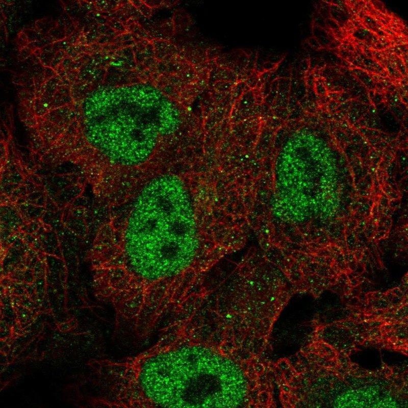 Atlas Antibodies Anti-NUP98 Antibody