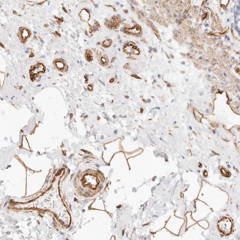 Atlas Antibodies Anti-NUS1 Antibody