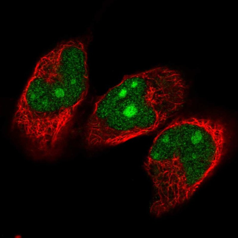 Atlas Antibodies Anti-NVL Antibody