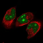 Atlas Antibodies Anti-NVL Antibody