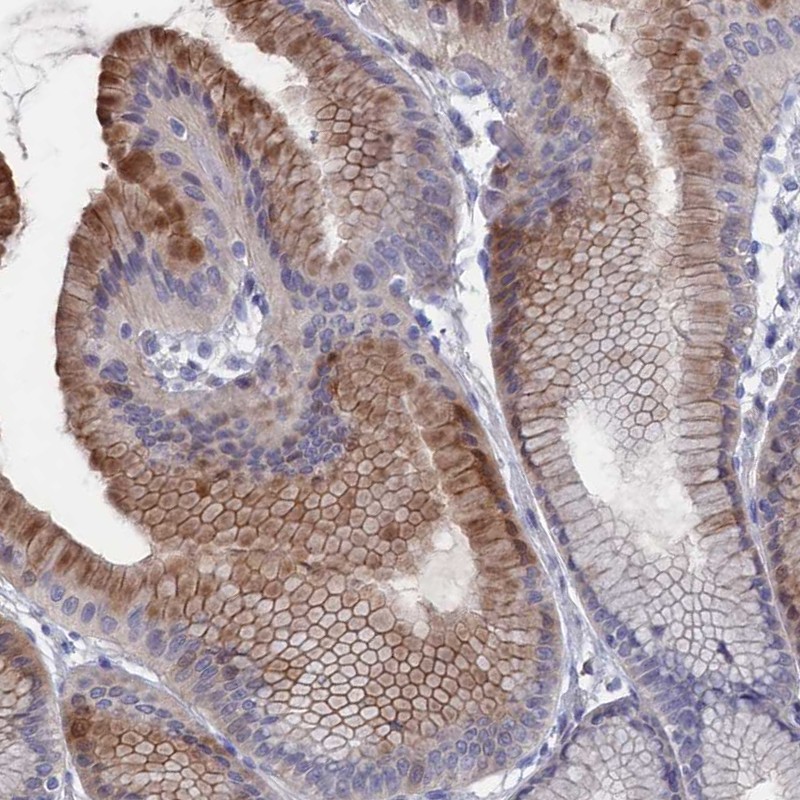 Atlas Antibodies Anti-NUTF2 Antibody