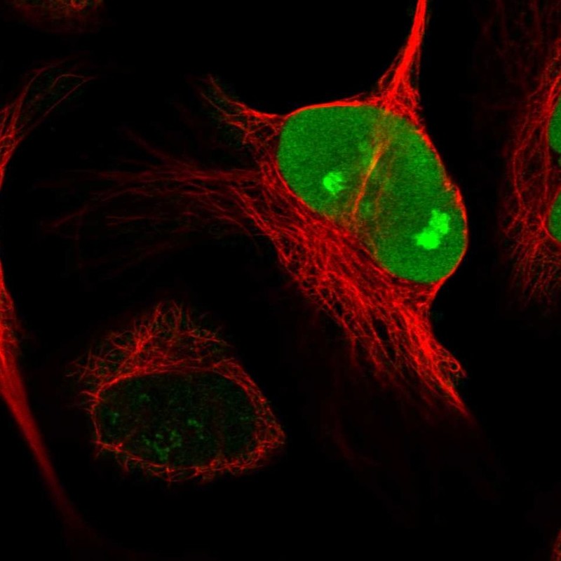 Atlas Antibodies Anti-NUSAP1 Antibody