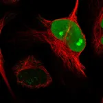 Atlas Antibodies Anti-NUSAP1 Antibody