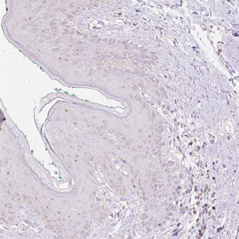 Atlas Antibodies Anti-NVL Antibody