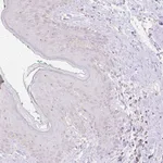 Atlas Antibodies Anti-NVL Antibody