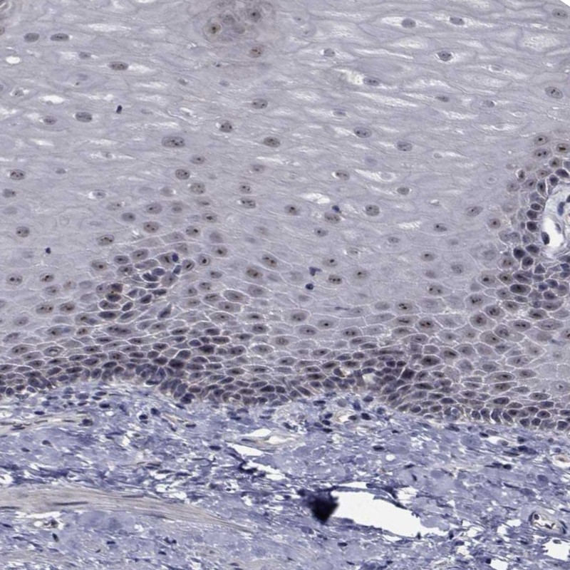 Atlas Antibodies Anti-NVL Antibody